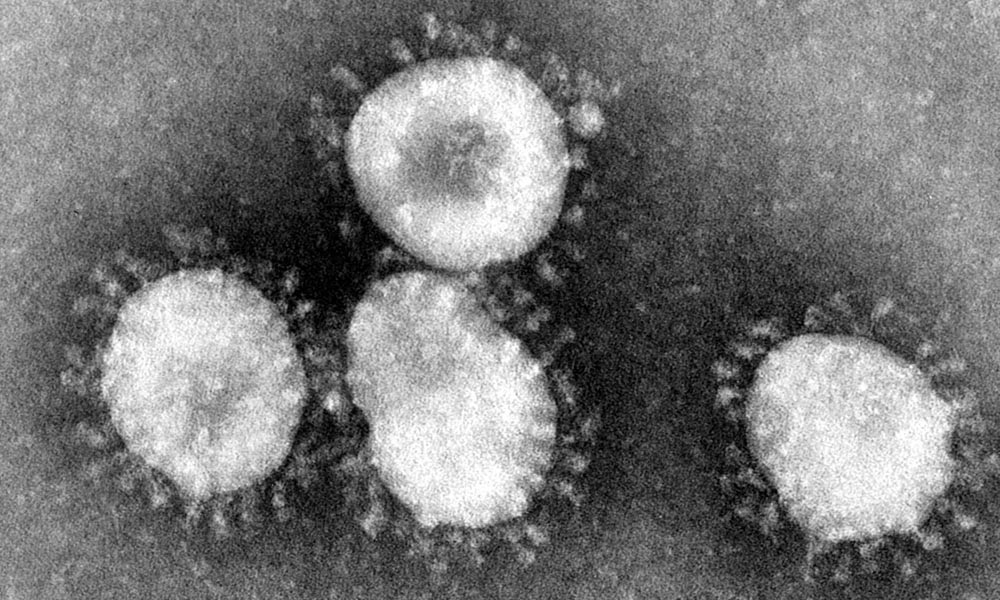 Onder een elektronenmicroscoop zie je de uitsteeksels met een bolletje erop waaraan het nieuwe virus zijn naam corona dankt.